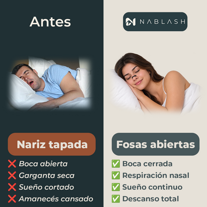 Dilatador nasal magnético reutilizable